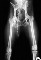 DBO Röntgen präoperativ