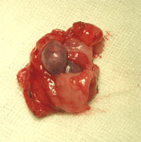 Abb-12-Ovariektomie-5-Ovar-
